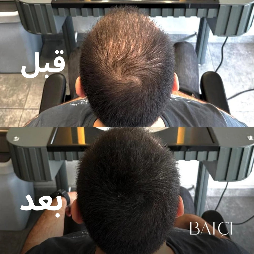 2 باتشي خافي عيوب الشعر 30مل